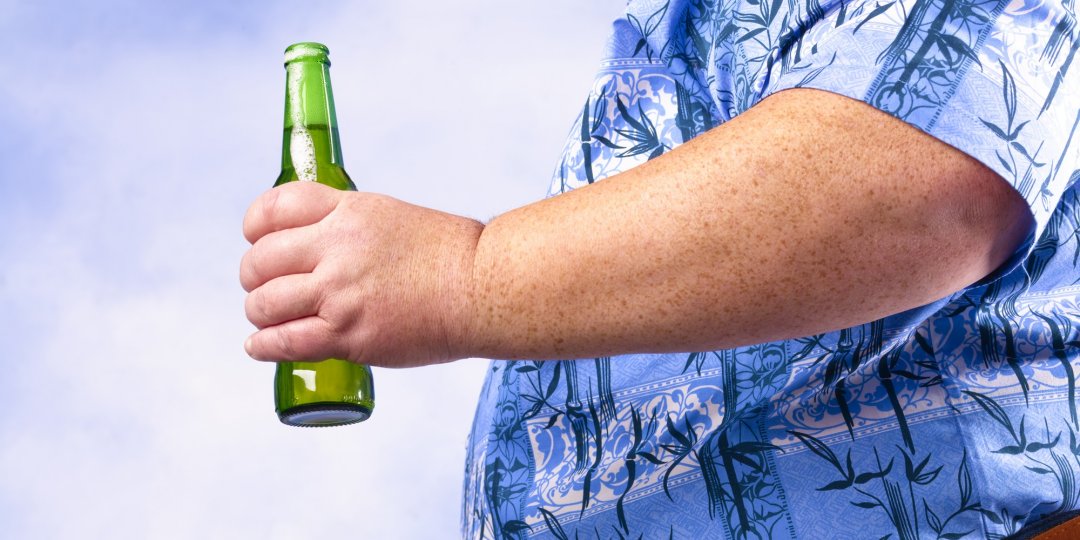 Obese man holding beer bottle against a sky background.