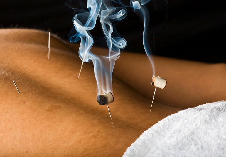 Moxibustion: What Is It and Does It Work?