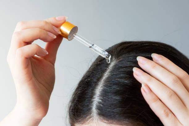 Anti-Hair Loss Medicine Market