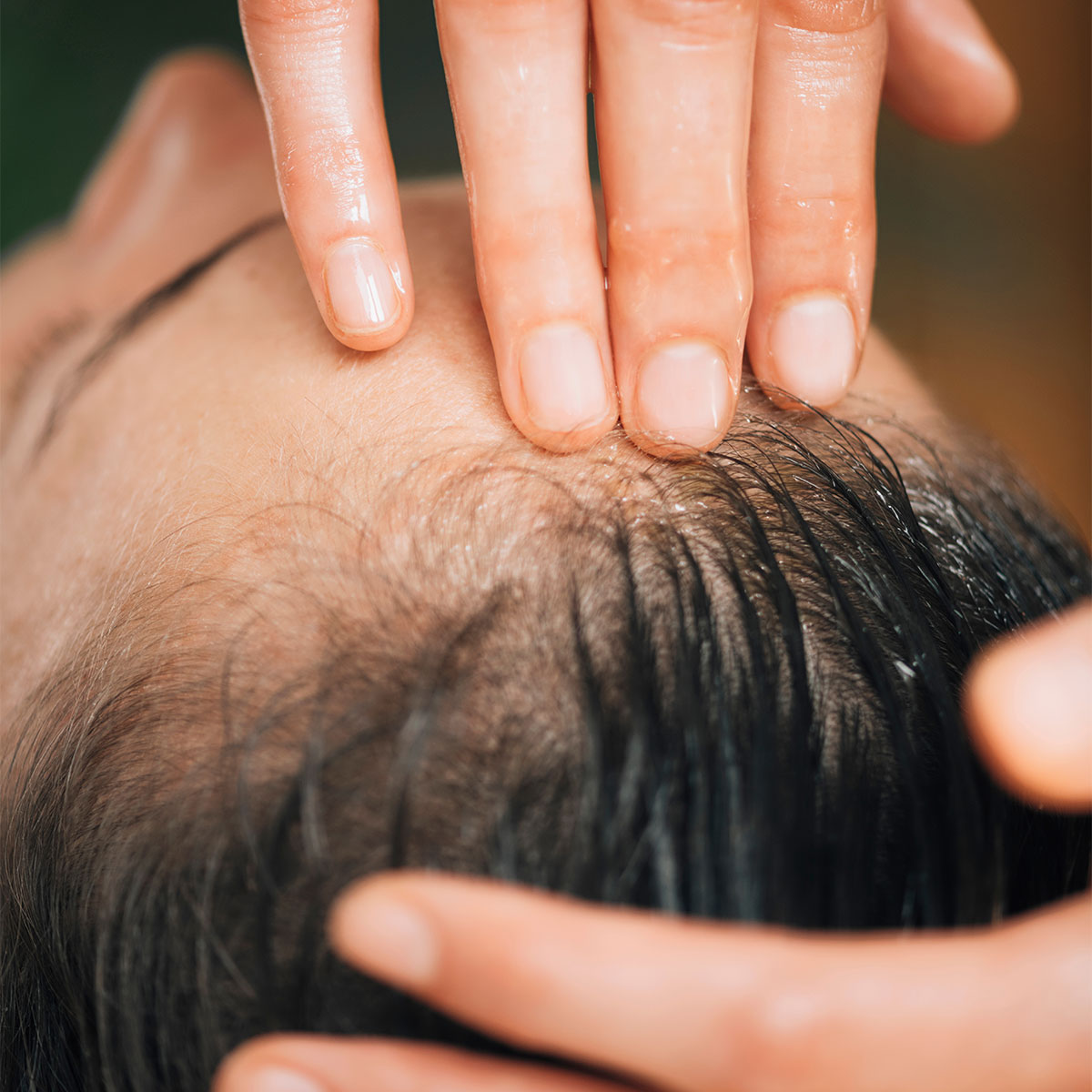 2 Scalp Oils Experts Swear By For Hair Loss