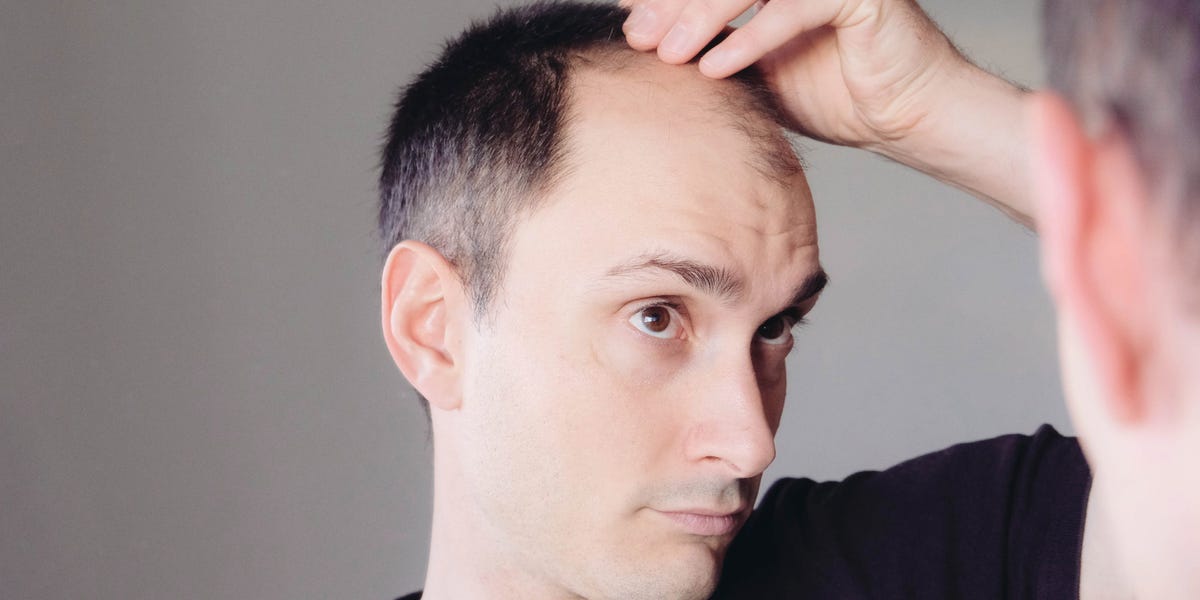 4 lifestyle changes that can help prevent early hair loss in men, according to a dermatologist