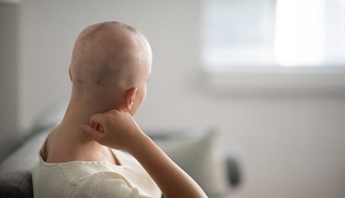 Hair loss after chemotherapy: 10 things to know