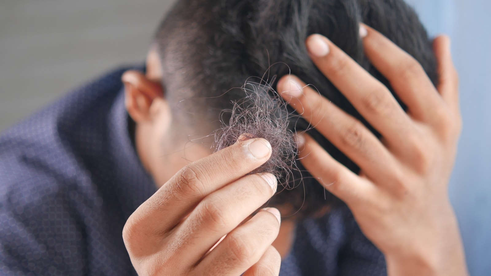 Hair thinning: Causes and treatment tips