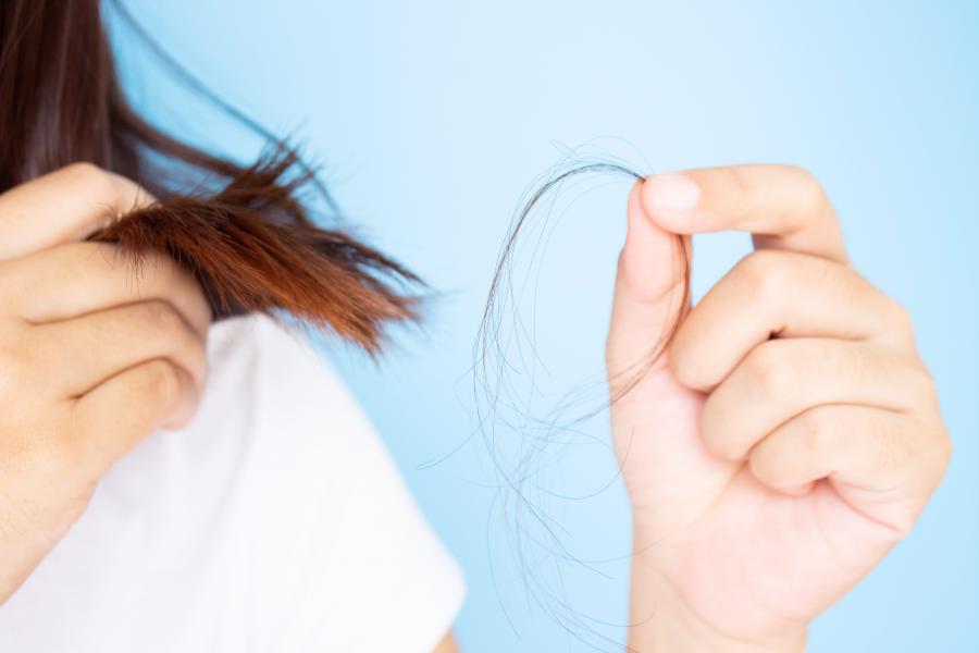 Anti-hair Loss Shampoo Market Study Providing Information on Top Key Players|Zhangguang101,Avalon.js,ACCA KAPPA,L'oreal