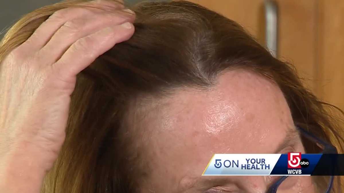 Hair growth medicine that comes in pill form