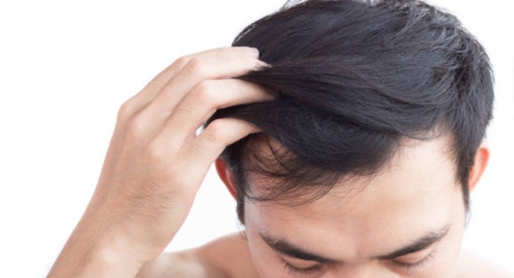 Provital Releases Holistic Active Ingredient to Combat Hair Loss and Greying Hair