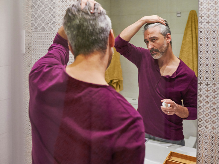 This Mail-In Test May Show if Minoxidil Will Help Your Hair Loss
