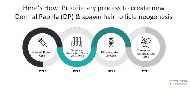 Stemson Therapeutics: Hair Follicles from Stem Cells | Hair Loss Cure 2020