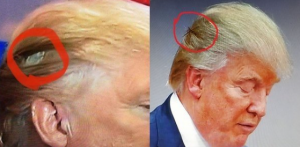 Trump uses hair clips, why? – WRassman,M.D. BaldingBlog